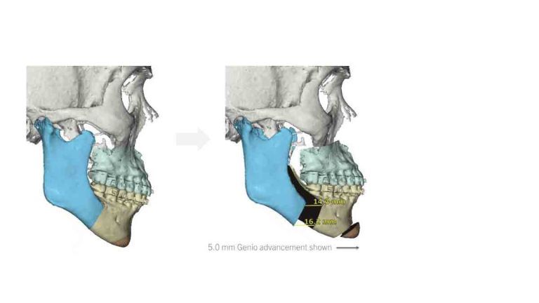 surgery planning