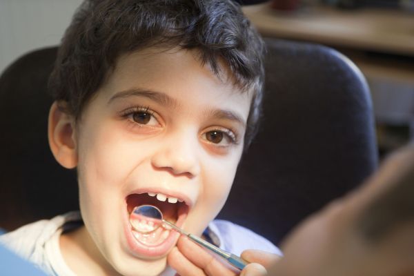 boy showing tooth