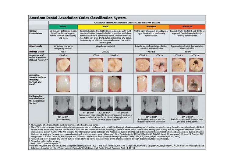 American Dental Association caries classification system.