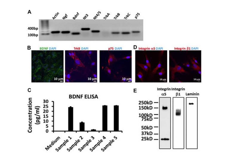 Expression of neurotrophic factors and cell adhesion molecules in human. DPSCs (A) Expression of the neurotrophic factors Ngf, Bdnf, Nt3, Nt4/5, their receptors TrkB, TrkC, and the co---receptor p75 in the human DPSCs. 10% samples were loaded for internal control actin (B) Cellular localization of BDNF, its receptor TrkB, and co---receptor p75 in DPSCs (C) ELISA of the secreted BDNF from DPSCs in the culture medium (n = 5) (D) immunofluorescent staining and (E) Western blotting of integrin a5, integrin b1 a