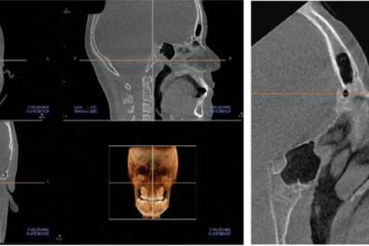 imaging of the palate