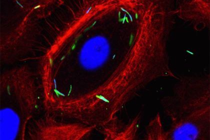 Intracellular localization of Fusobacterium nucleatum in GECs. Immunofluorescence confocal micrograph GECs infected with F. nucleatum (MOI of 100) for 1 h. The single optical section through the middle of the host cell confirms the intracellular localization of the bacteria. Fixed GECs were stained with phalloidin-tetramethylrhodamine B isothiocyanate (red) to show actin filaments, and anti-F. nucleatum antibody (green). Bar represents 20 µm.